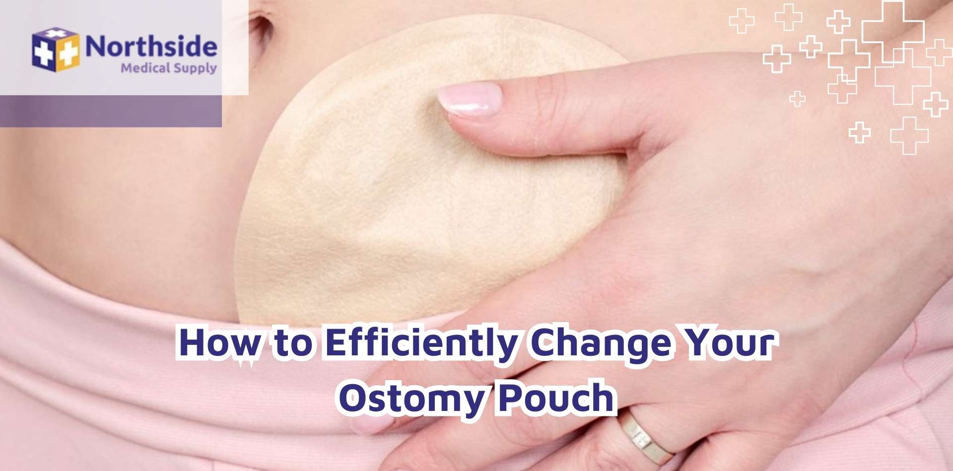 How to Efficiently Change Your Ostomy Pouch